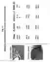 Fig. 11 - Methods of modulating metastasis and skeletal related events resulting from metastases