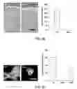 Fig. 06 - Parasite vaccine