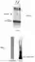 Fig. 12 - Parasite vaccine