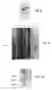 Fig. 13 - Parasite vaccine