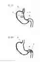 Fig. 06 - Ingestible formulations for transient, noninvasive reduction of gastric volume