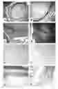 Fig. 01 - Methods of treating neurological conditions with hematopoeitic growth factors