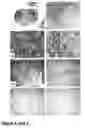 Fig. 06 - Methods of treating neurological conditions with hematopoeitic growth factors