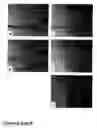Fig. 07 - Methods of treating neurological conditions with hematopoeitic growth factors