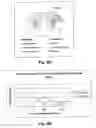 Fig. 13 - Methods of treating neurological conditions with hematopoeitic growth factors