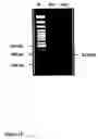Fig. 16 - Methods of treating neurological conditions with hematopoeitic growth factors