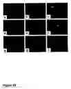 Fig. 30 - Methods of treating neurological conditions with hematopoeitic growth factors