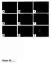 Fig. 31 - Methods of treating neurological conditions with hematopoeitic growth factors