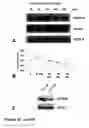 Fig. 35 - Methods of treating neurological conditions with hematopoeitic growth factors