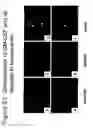 Fig. 70 - Methods of treating neurological conditions with hematopoeitic growth factors