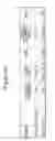 Fig. 55 - ANTAGONIZING INTERLEUKIN-21 RECEPTOR ACTIVITY
