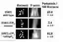 Fig. 01 - EspFnucleic acids and proteins and uses thereof