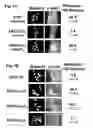 Fig. 02 - EspFnucleic acids and proteins and uses thereof