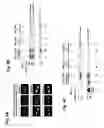 Fig. 05 - EspFnucleic acids and proteins and uses thereof