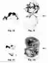 Fig. 03 - Method and reagents for the enhancement of virus transduction in the bladder epithelium