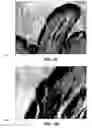 Fig. 09 - Method and reagents for the enhancement of virus transduction in the bladder epithelium