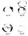 Fig. 11 - Method and reagents for the enhancement of virus transduction in the bladder epithelium