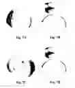 Fig. 13 - Method and reagents for the enhancement of virus transduction in the bladder epithelium