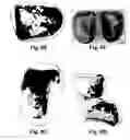 Fig. 15 - Method and reagents for the enhancement of virus transduction in the bladder epithelium