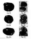 Fig. 16 - Method and reagents for the enhancement of virus transduction in the bladder epithelium