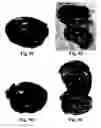 Fig. 19 - Method and reagents for the enhancement of virus transduction in the bladder epithelium