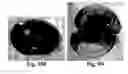 Fig. 20 - Method and reagents for the enhancement of virus transduction in the bladder epithelium