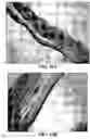Fig. 21 - Method and reagents for the enhancement of virus transduction in the bladder epithelium