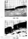 Fig. 23 - Method and reagents for the enhancement of virus transduction in the bladder epithelium