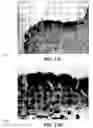 Fig. 27 - Method and reagents for the enhancement of virus transduction in the bladder epithelium