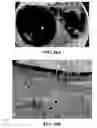Fig. 33 - Method and reagents for the enhancement of virus transduction in the bladder epithelium
