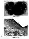 Fig. 35 - Method and reagents for the enhancement of virus transduction in the bladder epithelium