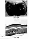 Fig. 37 - Method and reagents for the enhancement of virus transduction in the bladder epithelium