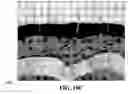 Fig. 38 - Method and reagents for the enhancement of virus transduction in the bladder epithelium