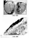 Fig. 41 - Method and reagents for the enhancement of virus transduction in the bladder epithelium
