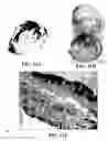 Fig. 43 - Method and reagents for the enhancement of virus transduction in the bladder epithelium