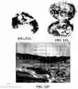 Fig. 45 - Method and reagents for the enhancement of virus transduction in the bladder epithelium