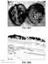 Fig. 53 - Method and reagents for the enhancement of virus transduction in the bladder epithelium