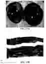 Fig. 55 - Method and reagents for the enhancement of virus transduction in the bladder epithelium
