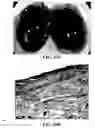Fig. 59 - Method and reagents for the enhancement of virus transduction in the bladder epithelium