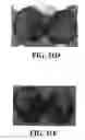 Fig. 64 - Method and reagents for the enhancement of virus transduction in the bladder epithelium