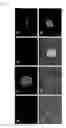 Fig. 02 - Pluripotent Stem Cell Derived from Cardiac Tissue