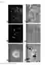 Fig. 08 - Pluripotent Stem Cell Derived from Cardiac Tissue