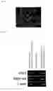 Fig. 13 - Pluripotent Stem Cell Derived from Cardiac Tissue