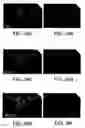 Fig. 58 - Procurement, isolation and cryopreservation of endometrial/menstrual cells