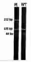 Fig. 01 -  mutation T1796A in thyroid cancers