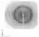Fig. 04 - Functional negative regulatory domain sequences from human NOTCH1 and 2 and isolated LNR domains from human NOTCH1