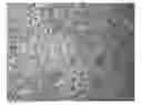 Fig. 01 - Methods and compositions for selective modulation of vascularization
