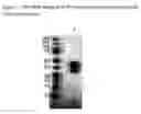 Fig. 11 - BMP-3 antibodies and related methods