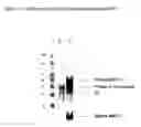 Fig. 12 - BMP-3 antibodies and related methods