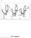 Fig. 19 - Cross-β structure comprising amyloid-binding proteins and methods for detection of the cross-β structure, for modulating cross-β structures fiber formation and modulating cross-β structure-mediated toxicity